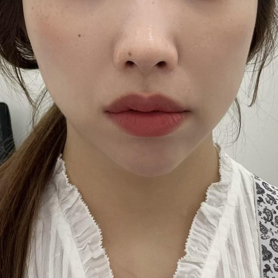 後