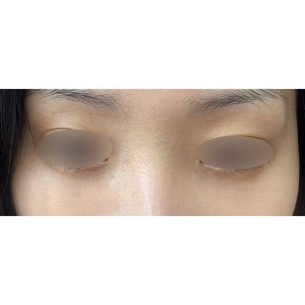 后