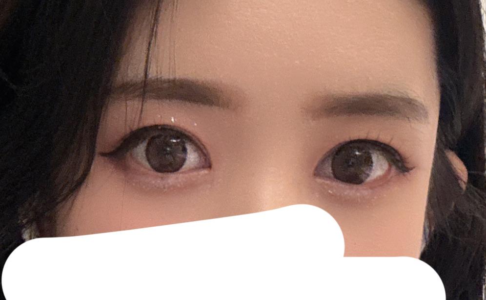 後
