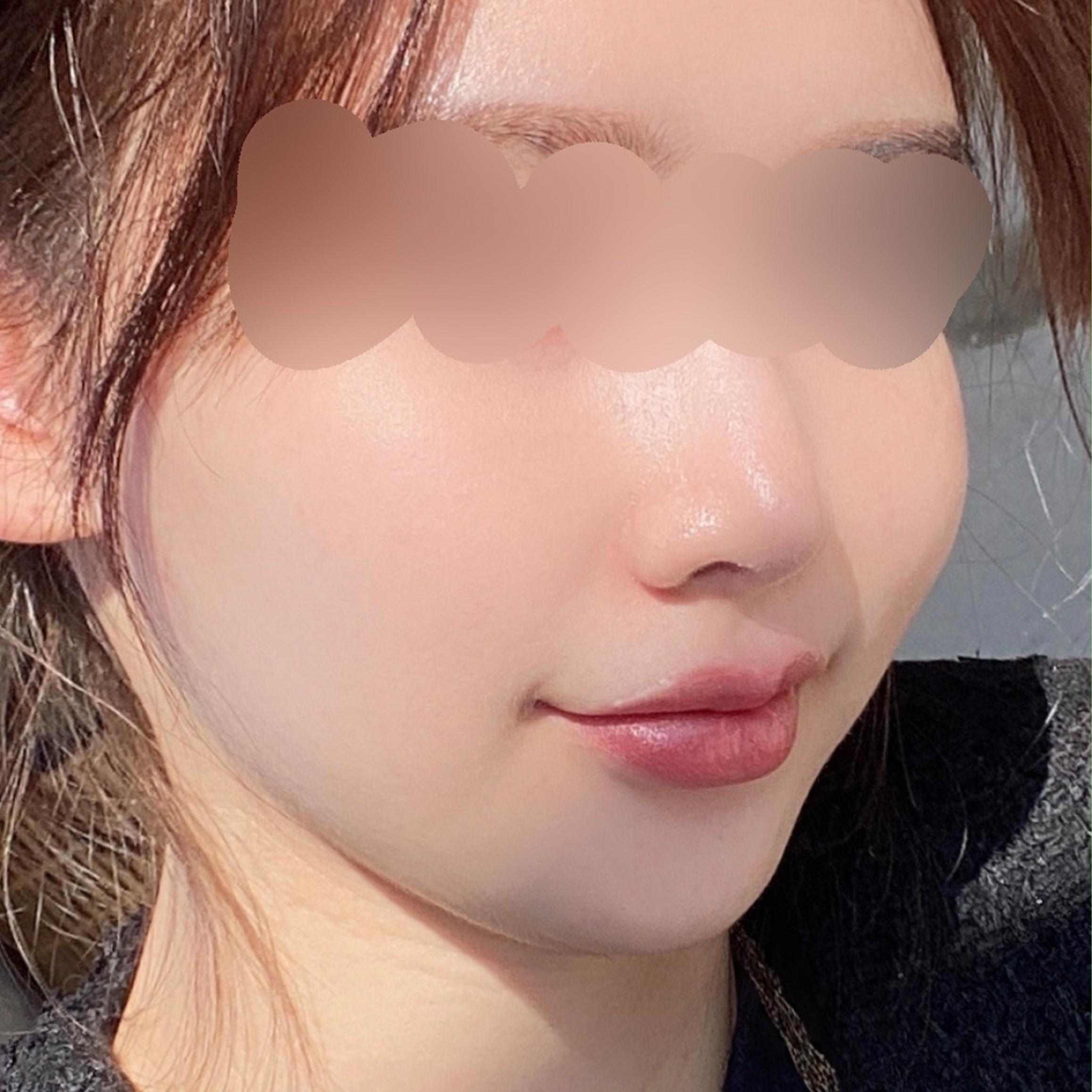 後