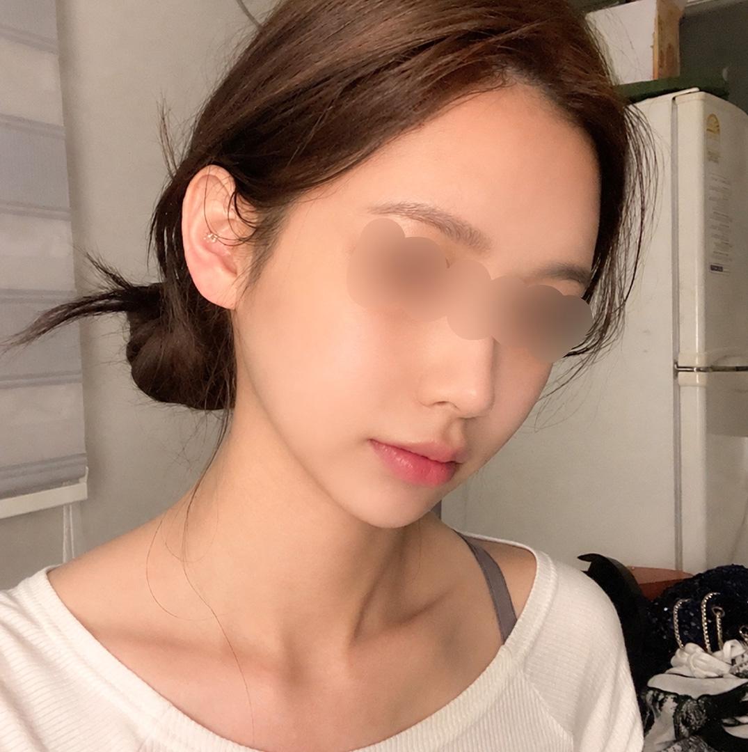 後