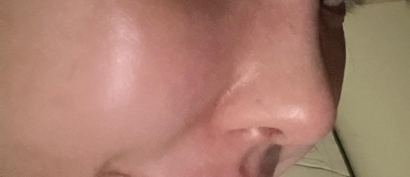後