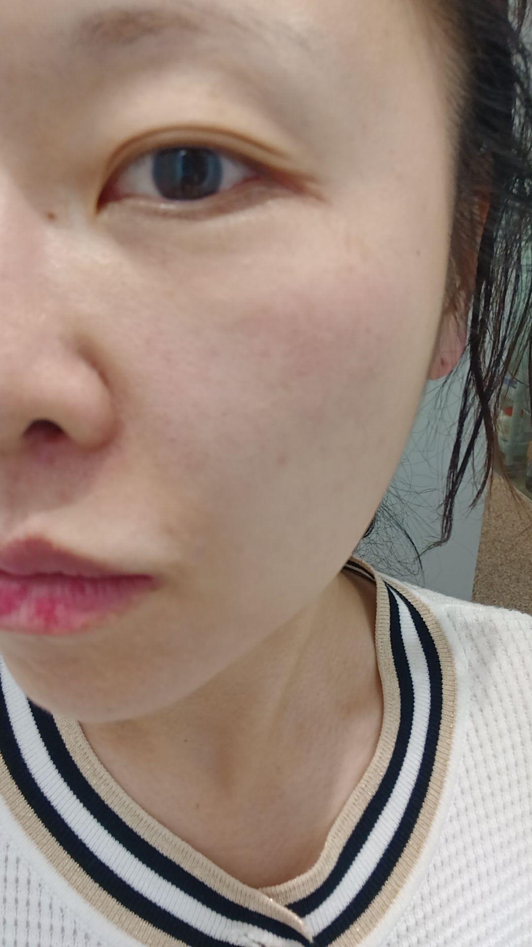 後