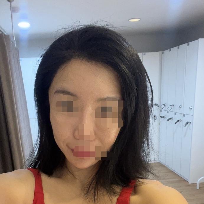 後