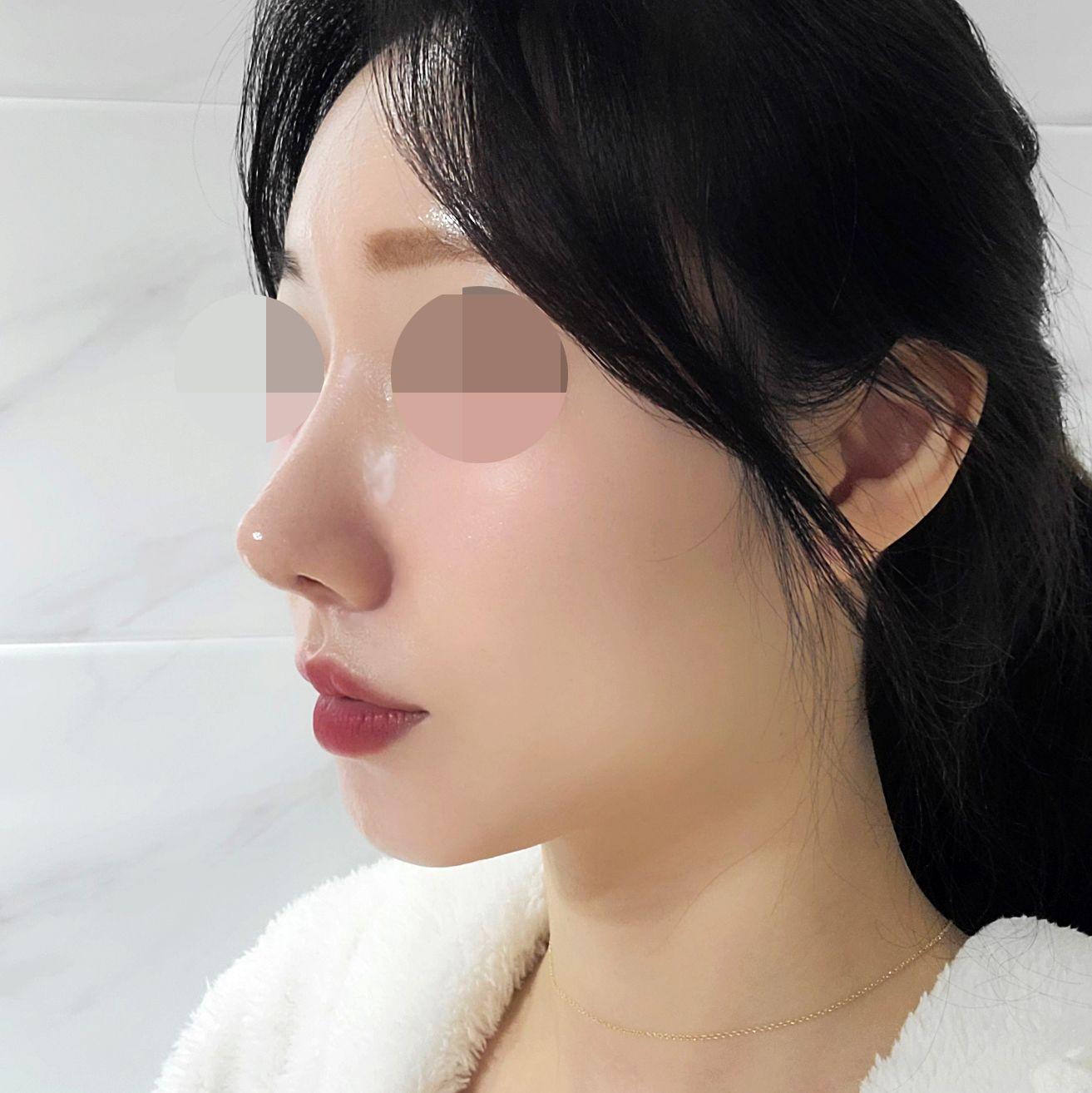 フェリックスって、鼻と顎、こんなに変わったの？ : r/kpop_uncensored, image size:1313x1314