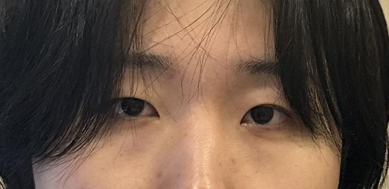 前