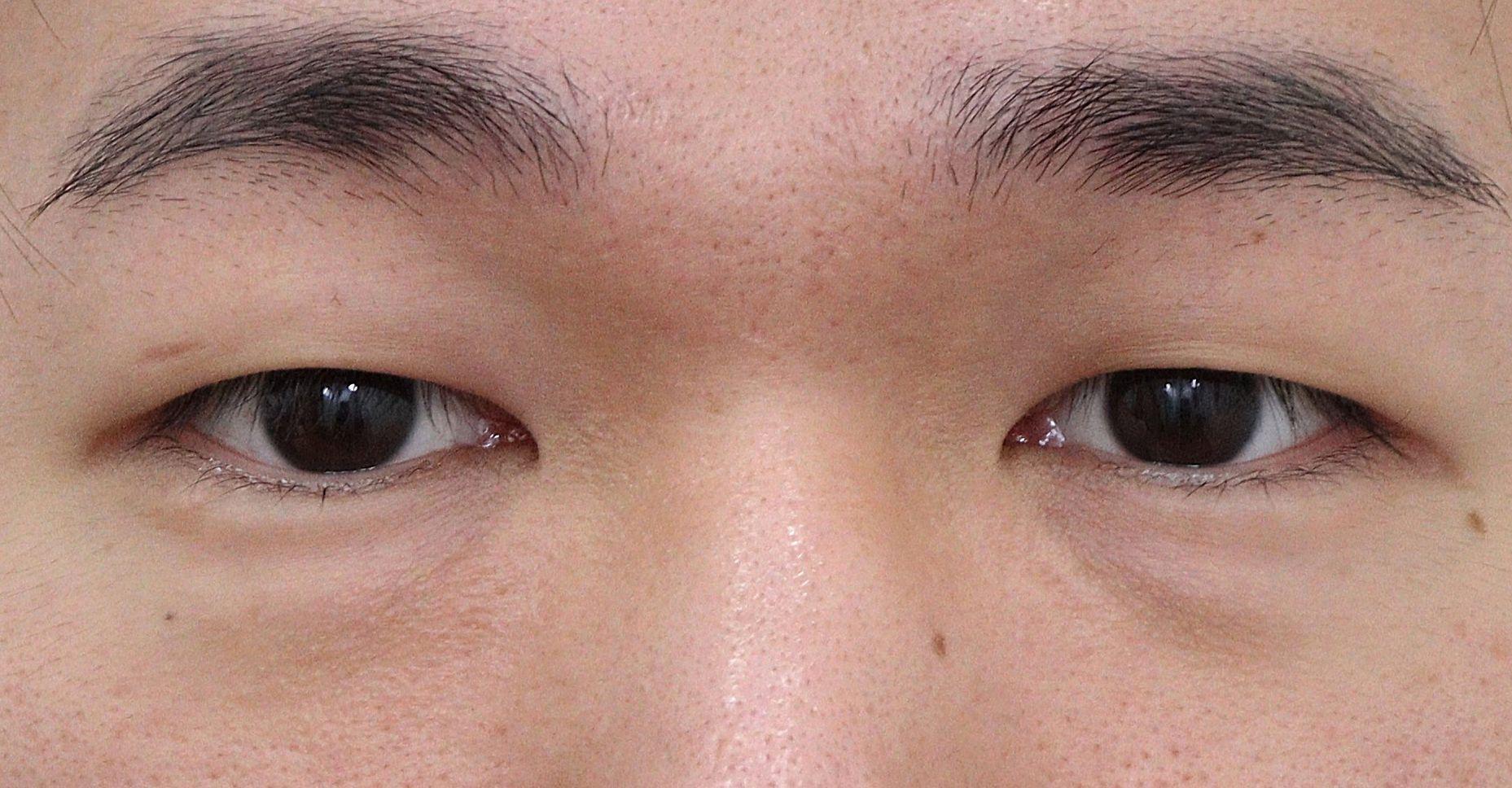 後