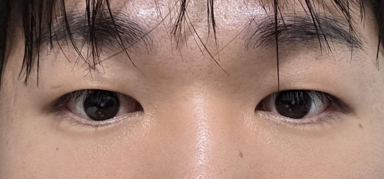 後
