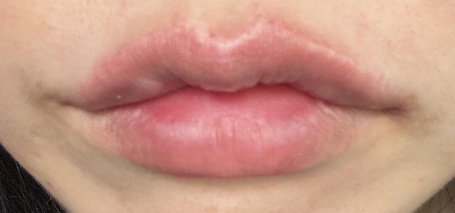 后