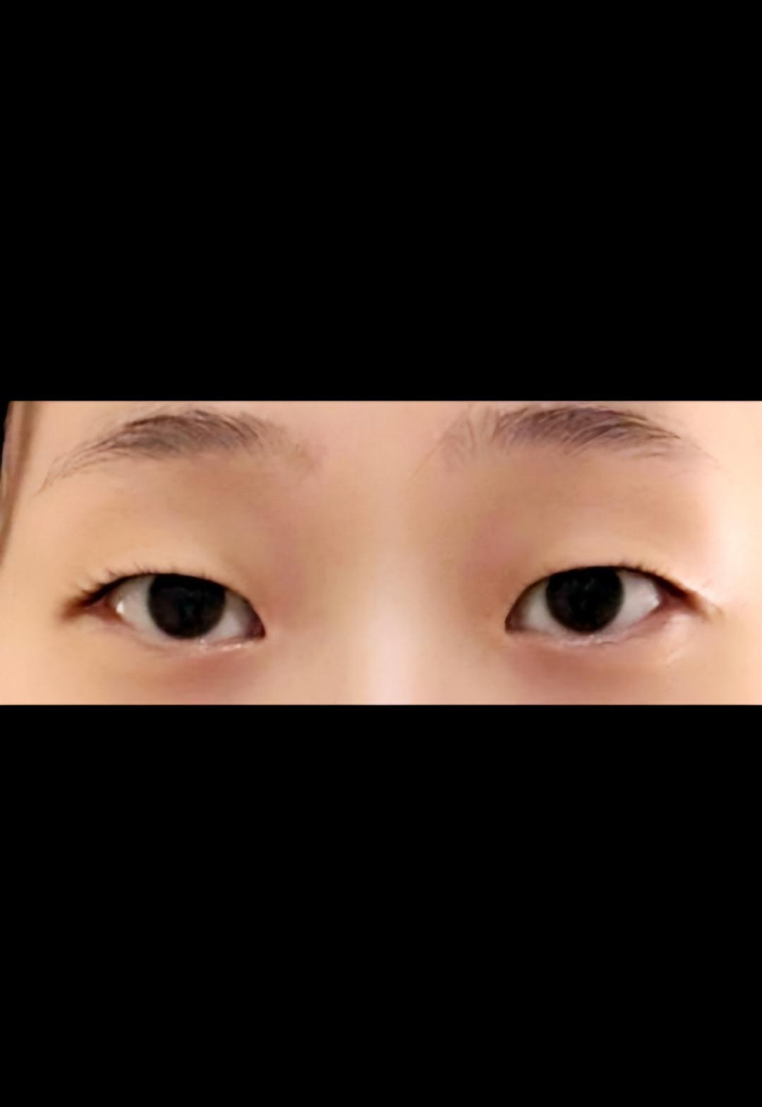 後
