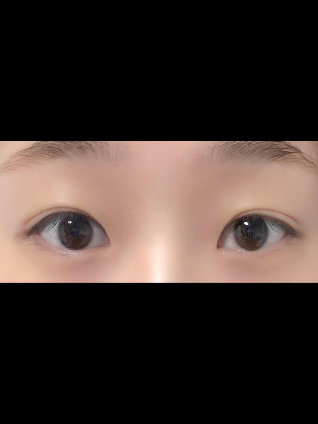 後