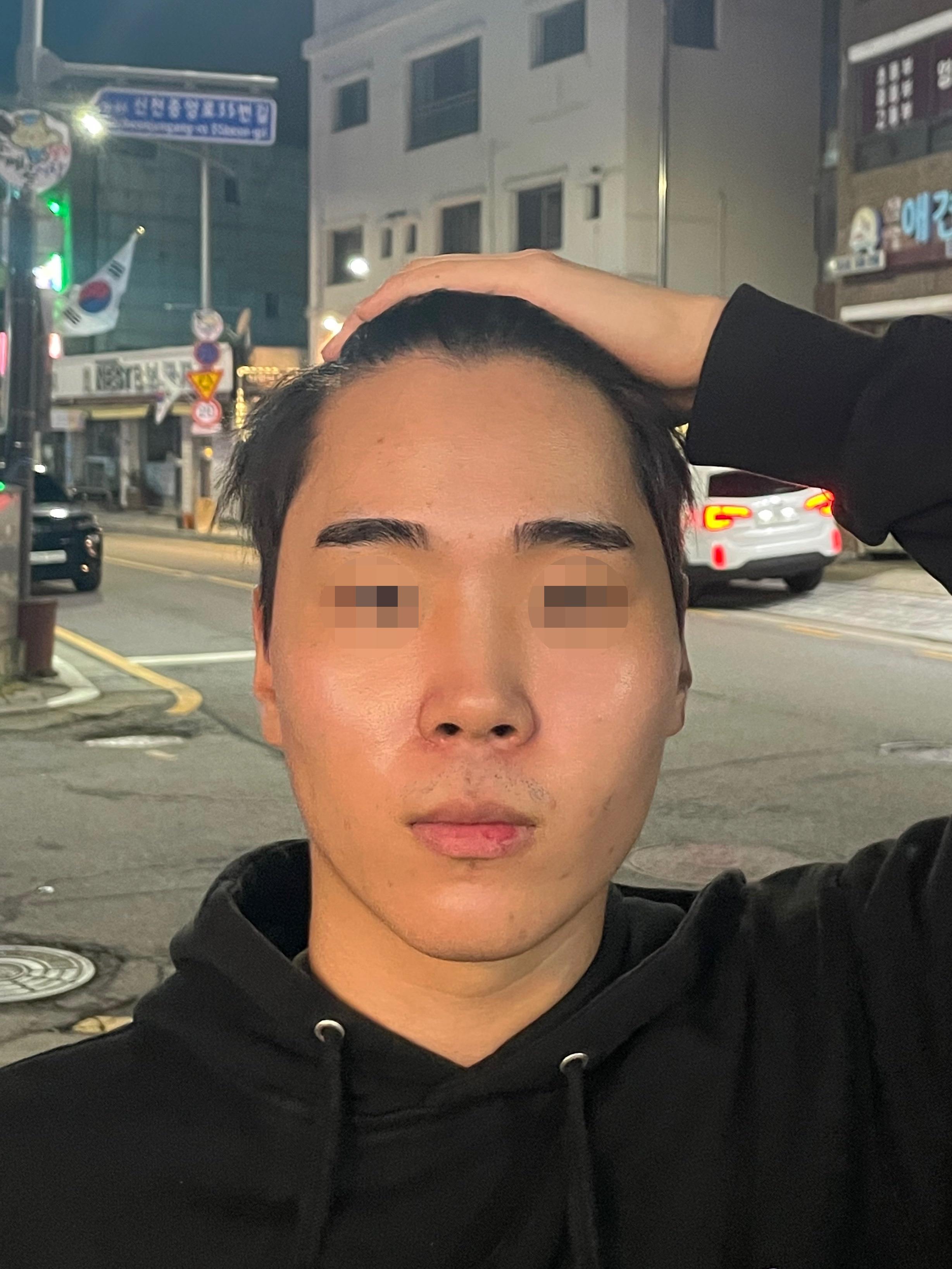 後