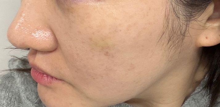 After