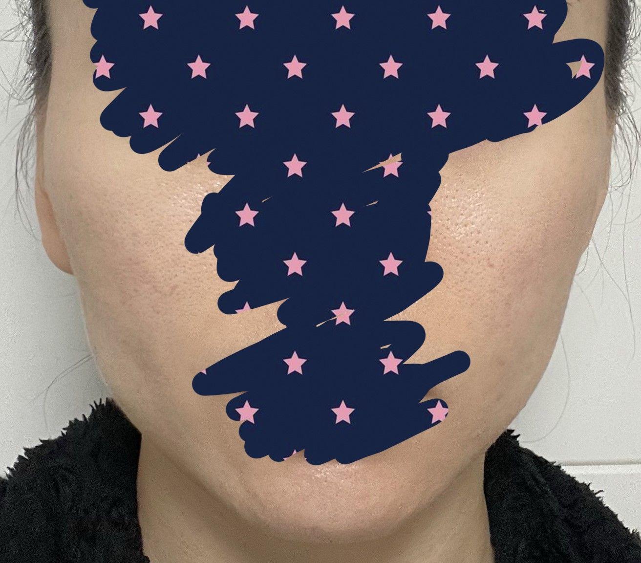 後