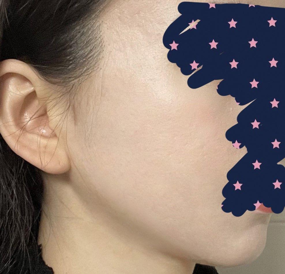 後