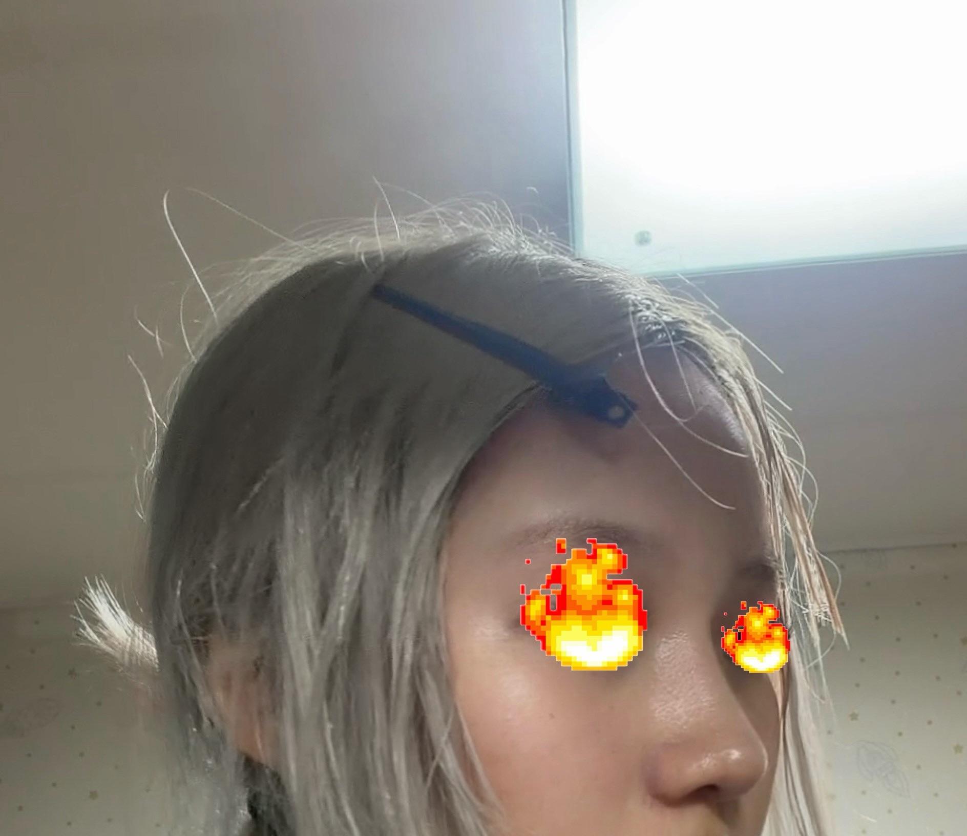 後