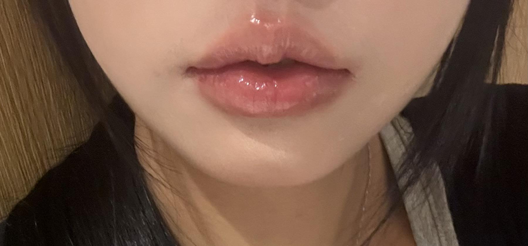 後