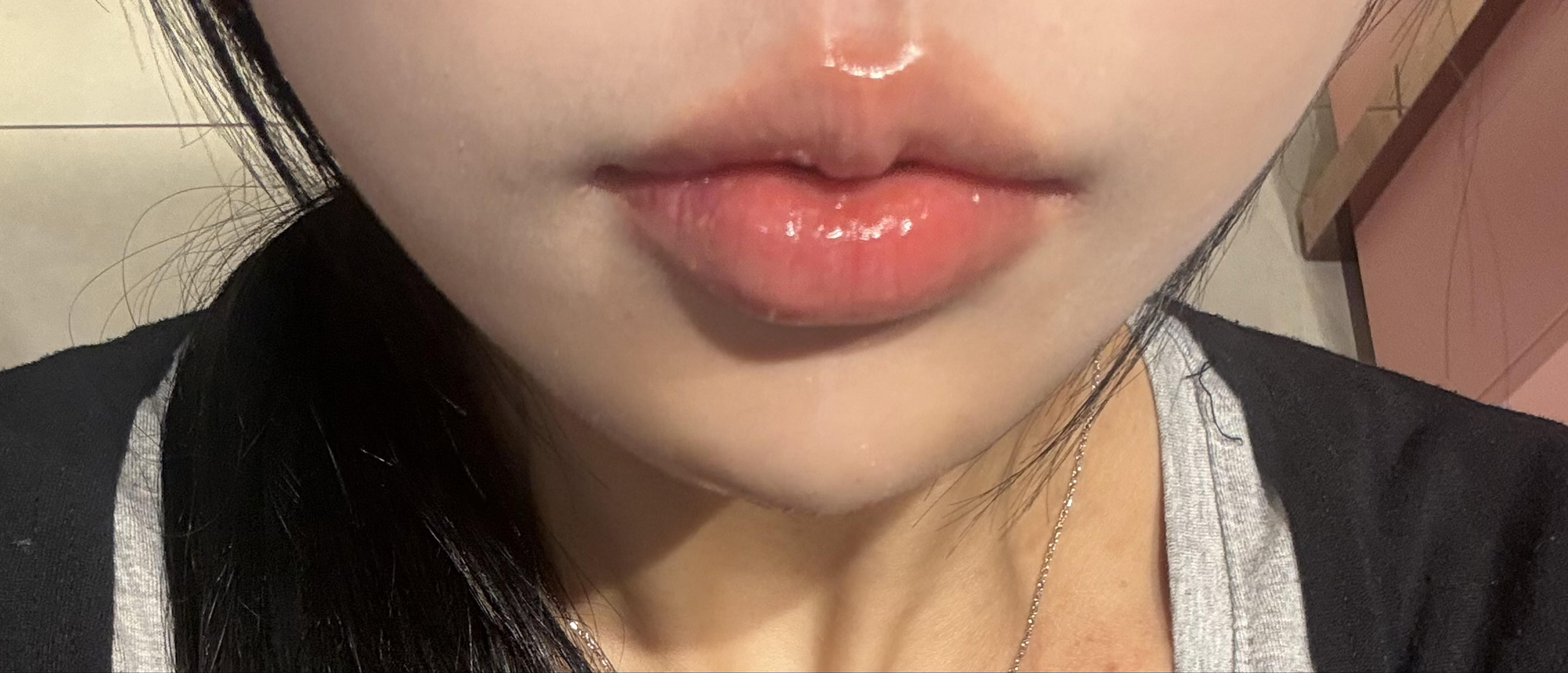 後