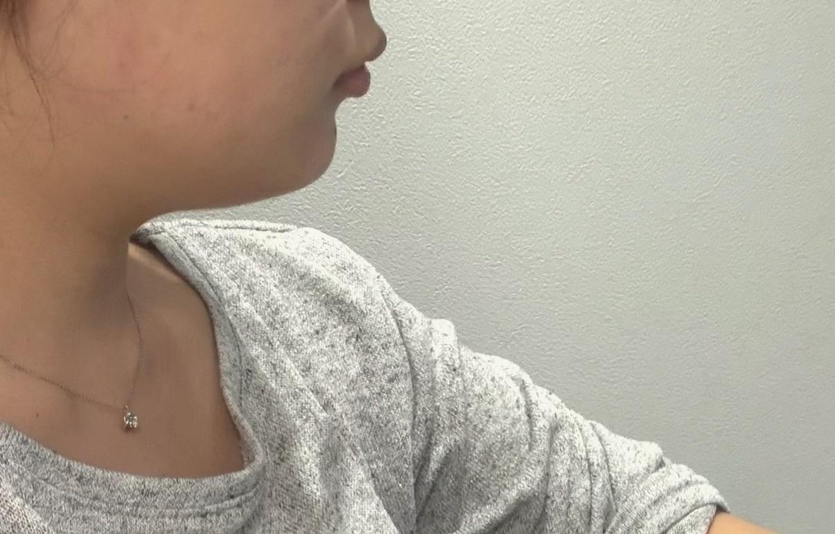 前