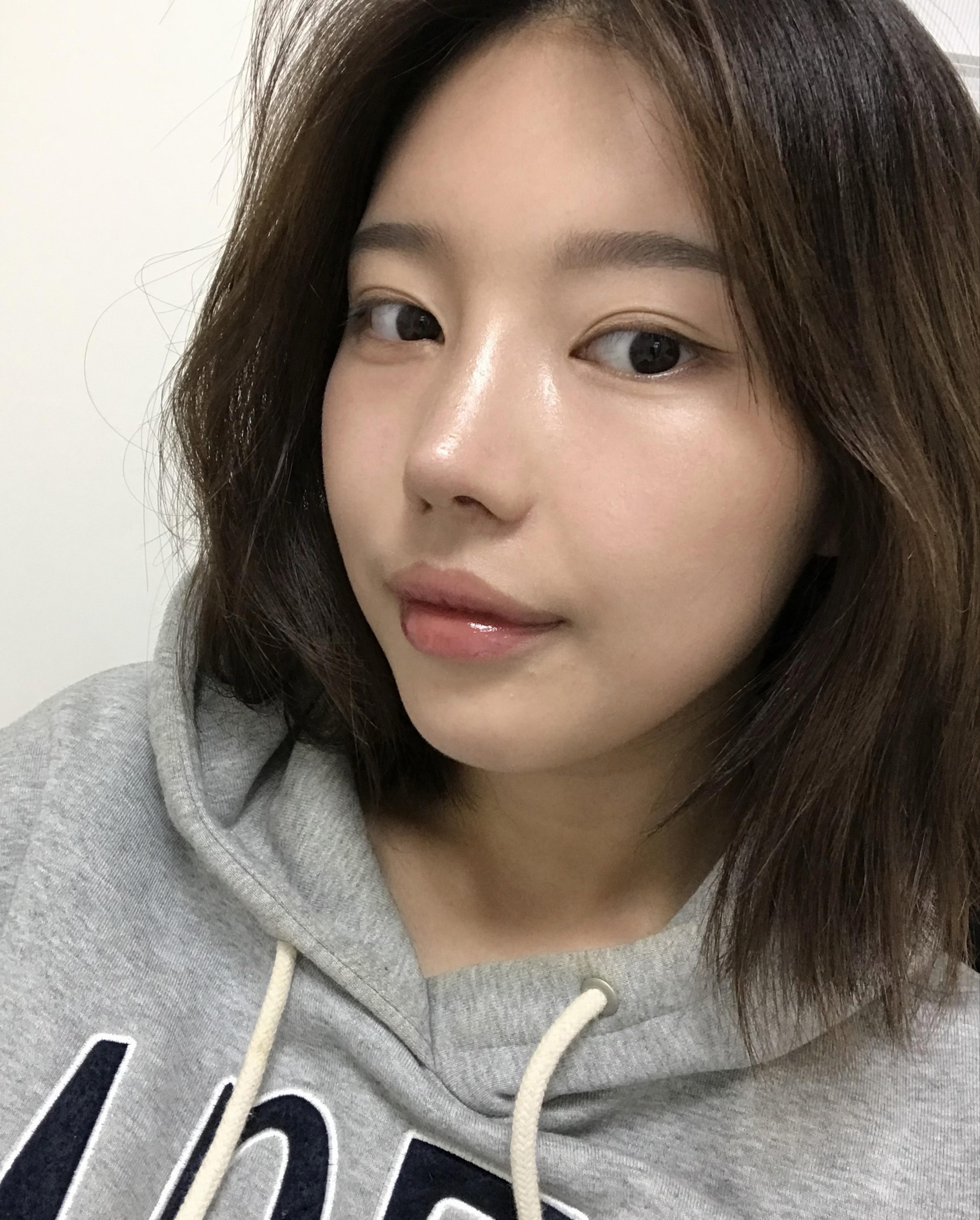 後