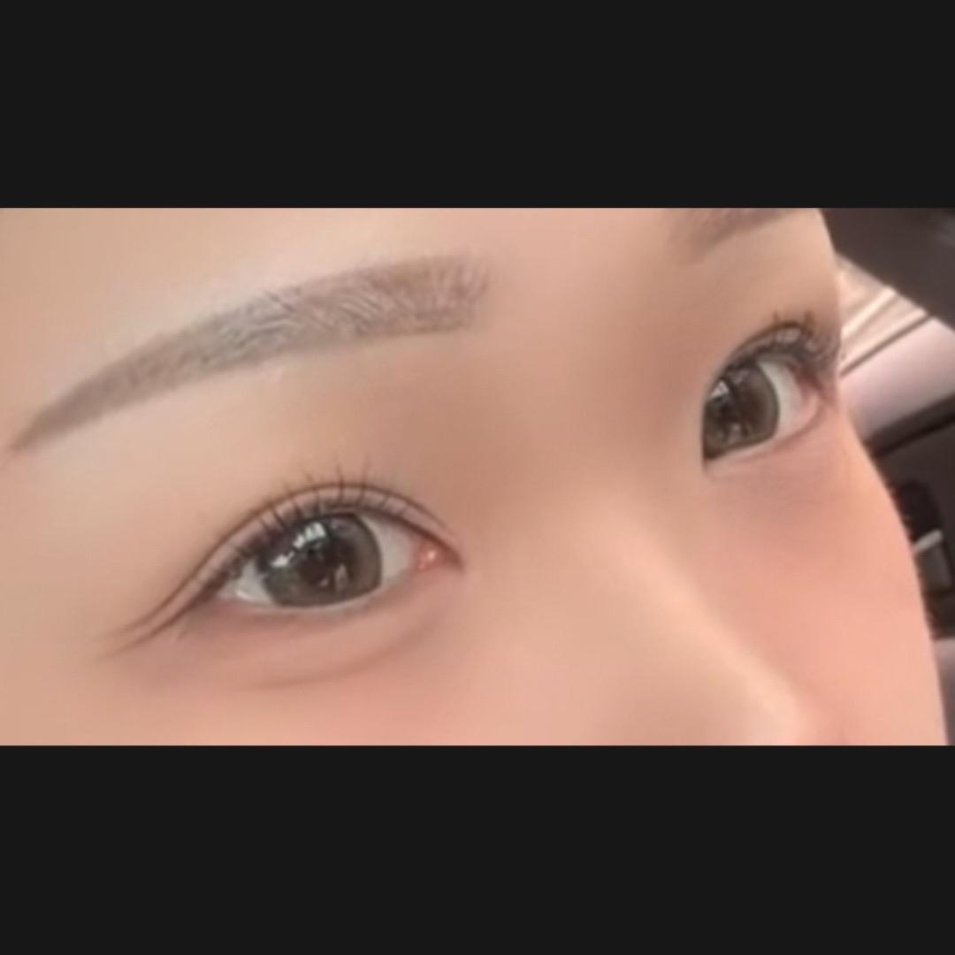 後