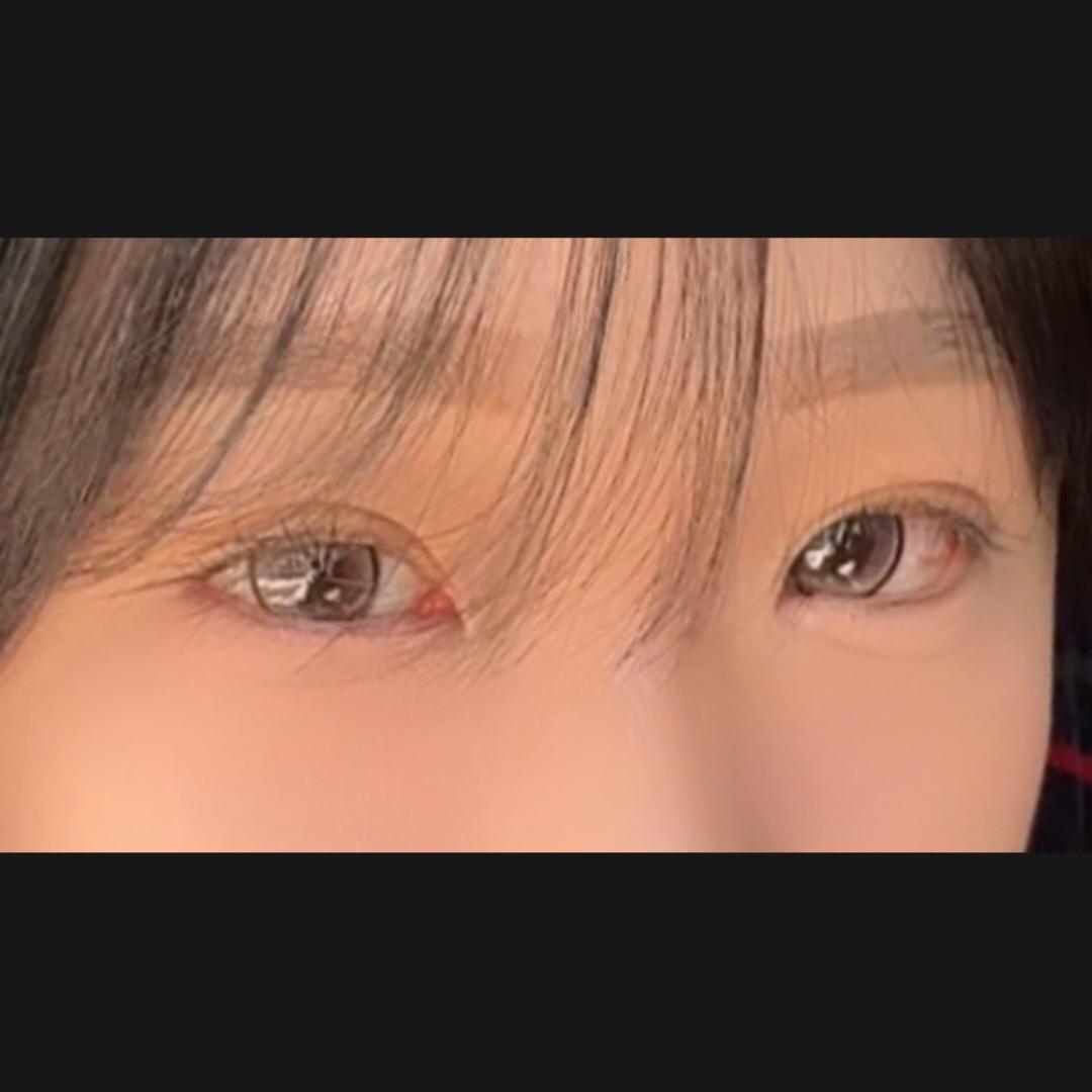 後