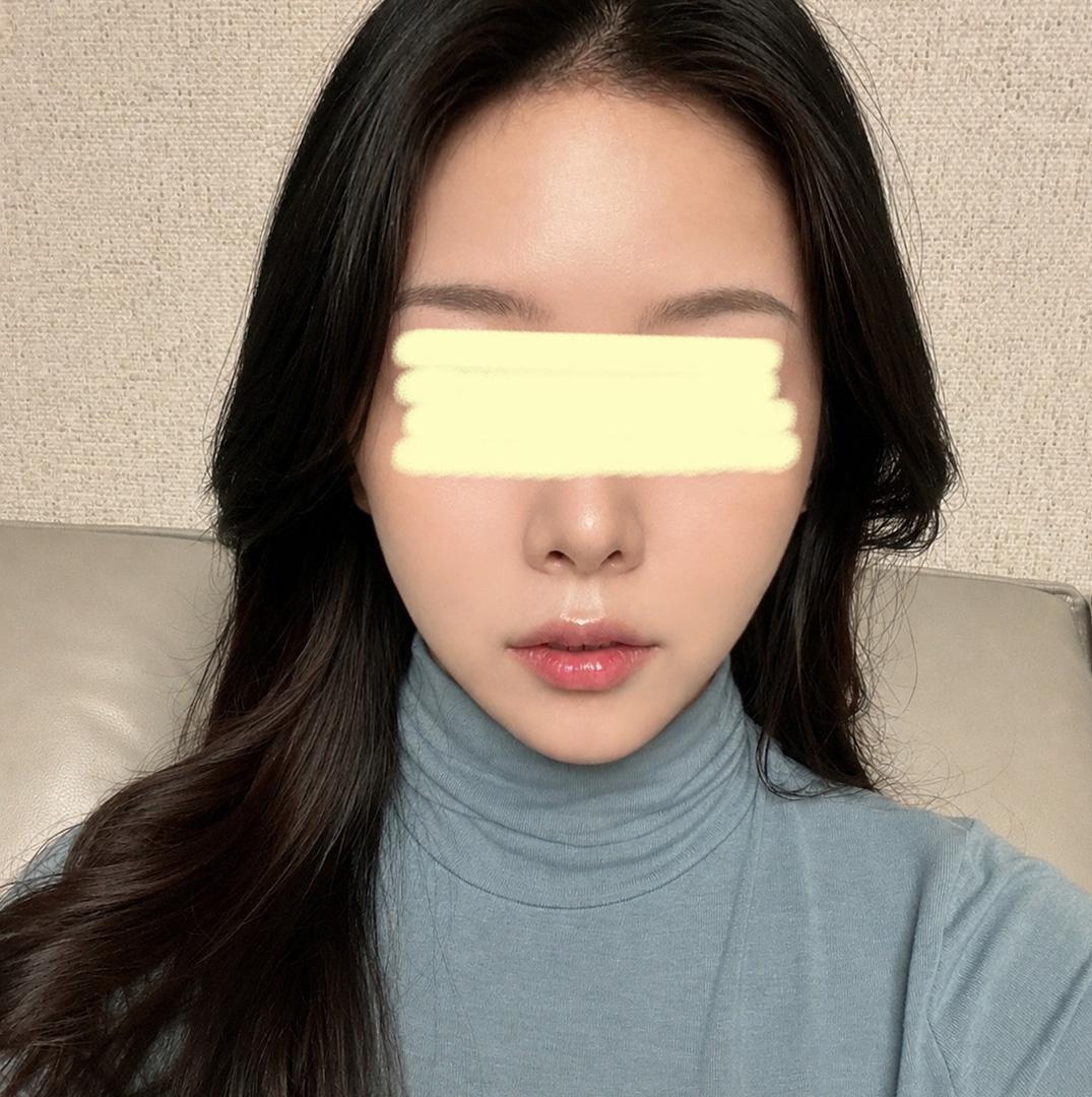 後