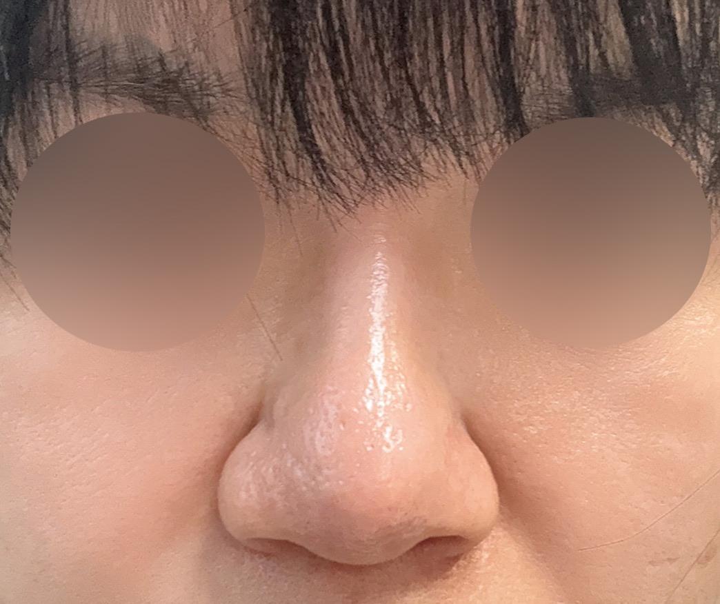 後