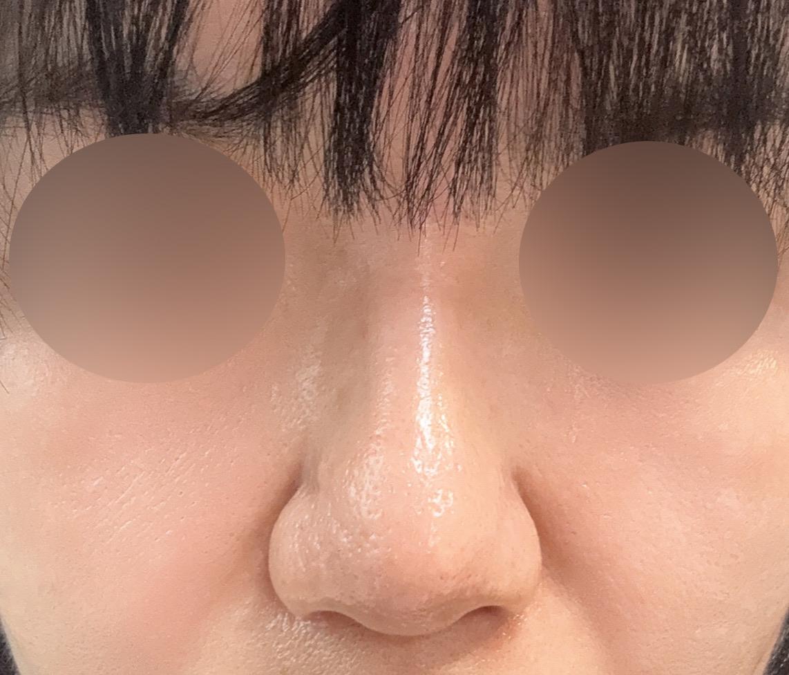 後