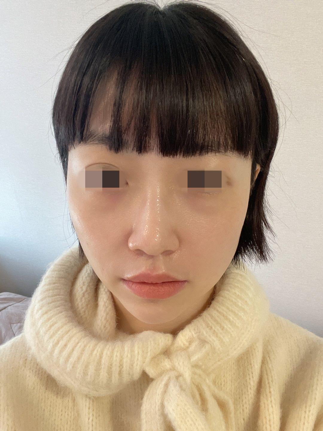 後