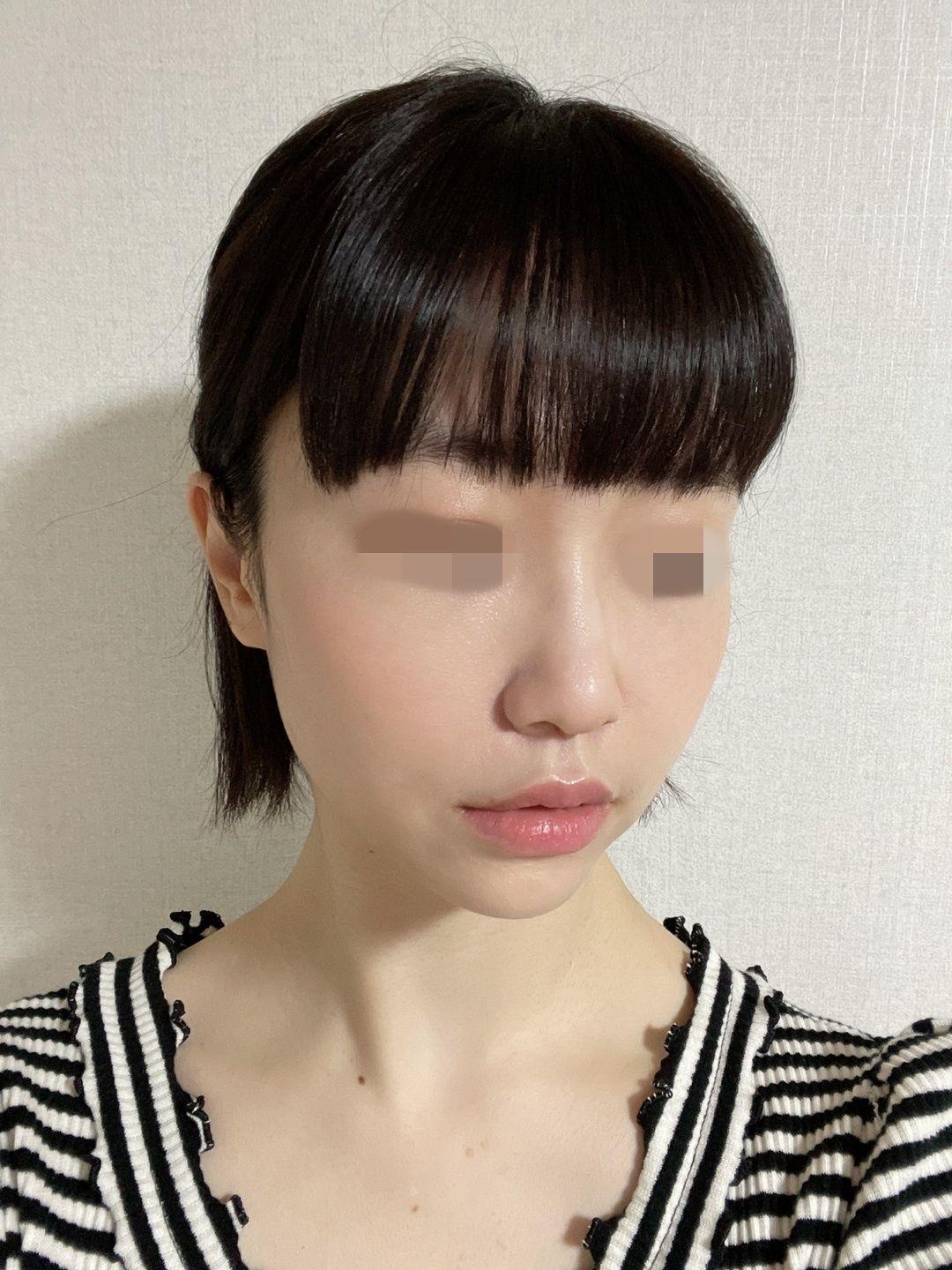 後