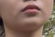 後