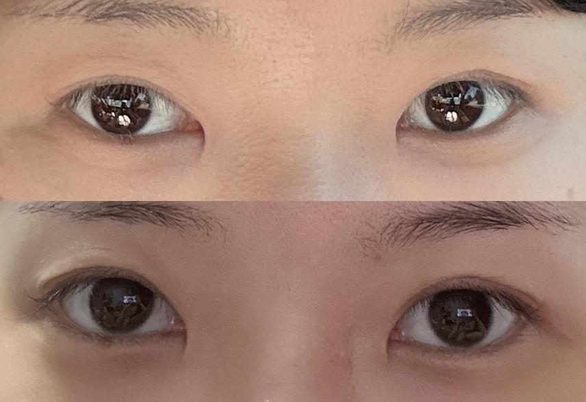 後
