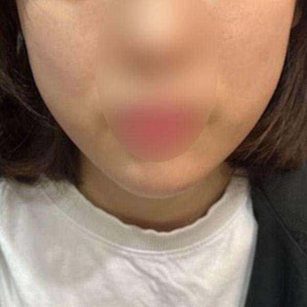 前