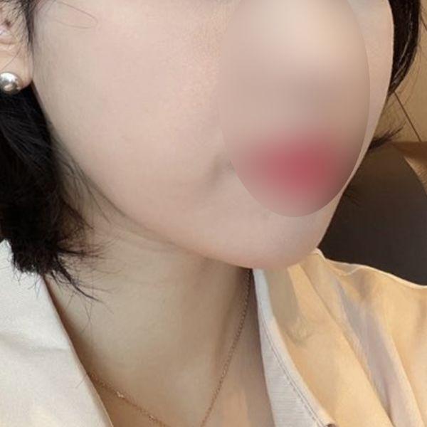 後
