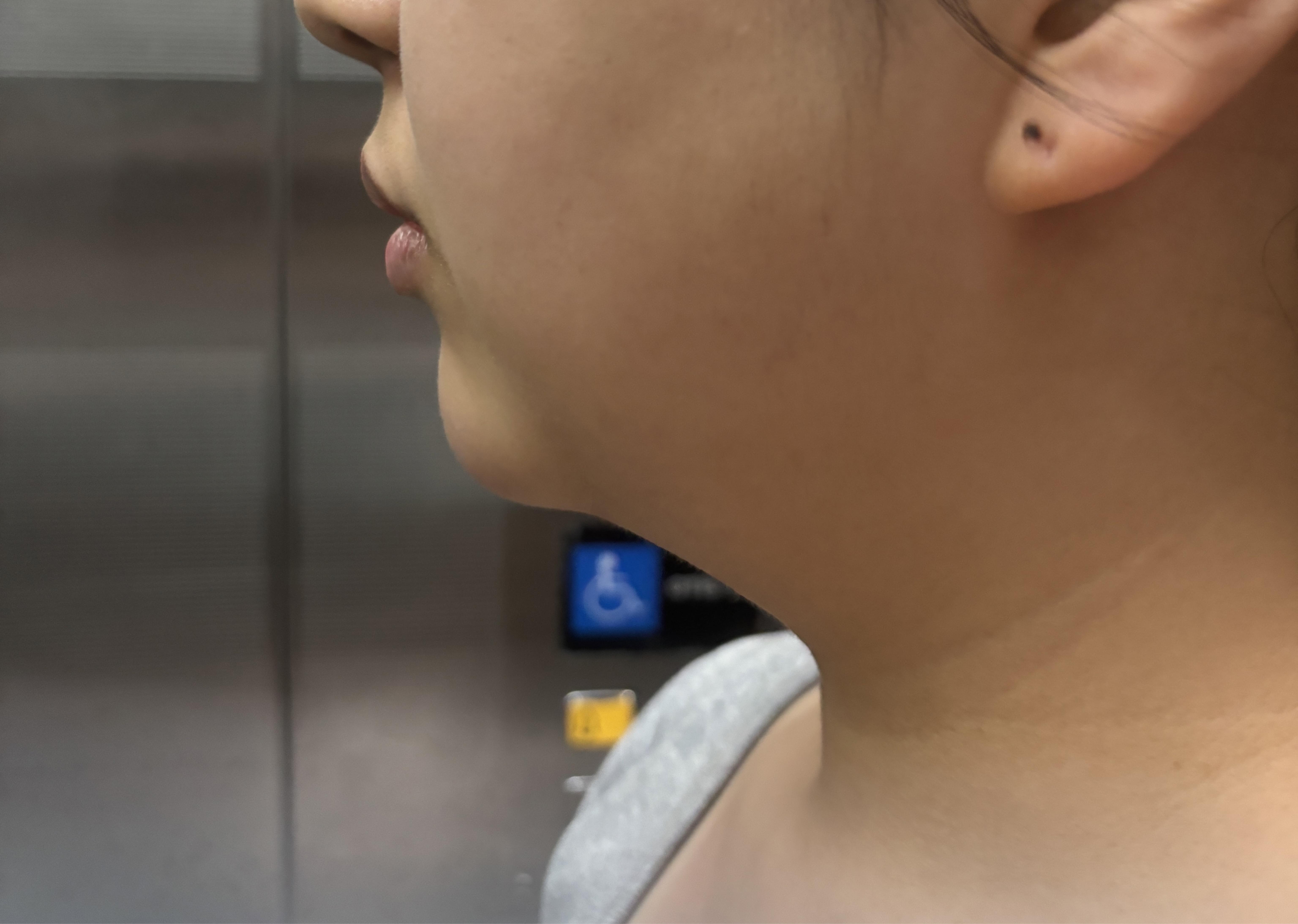 後