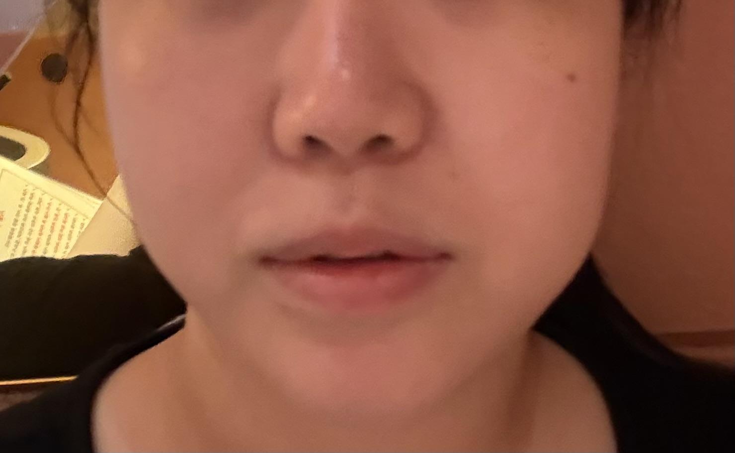 後