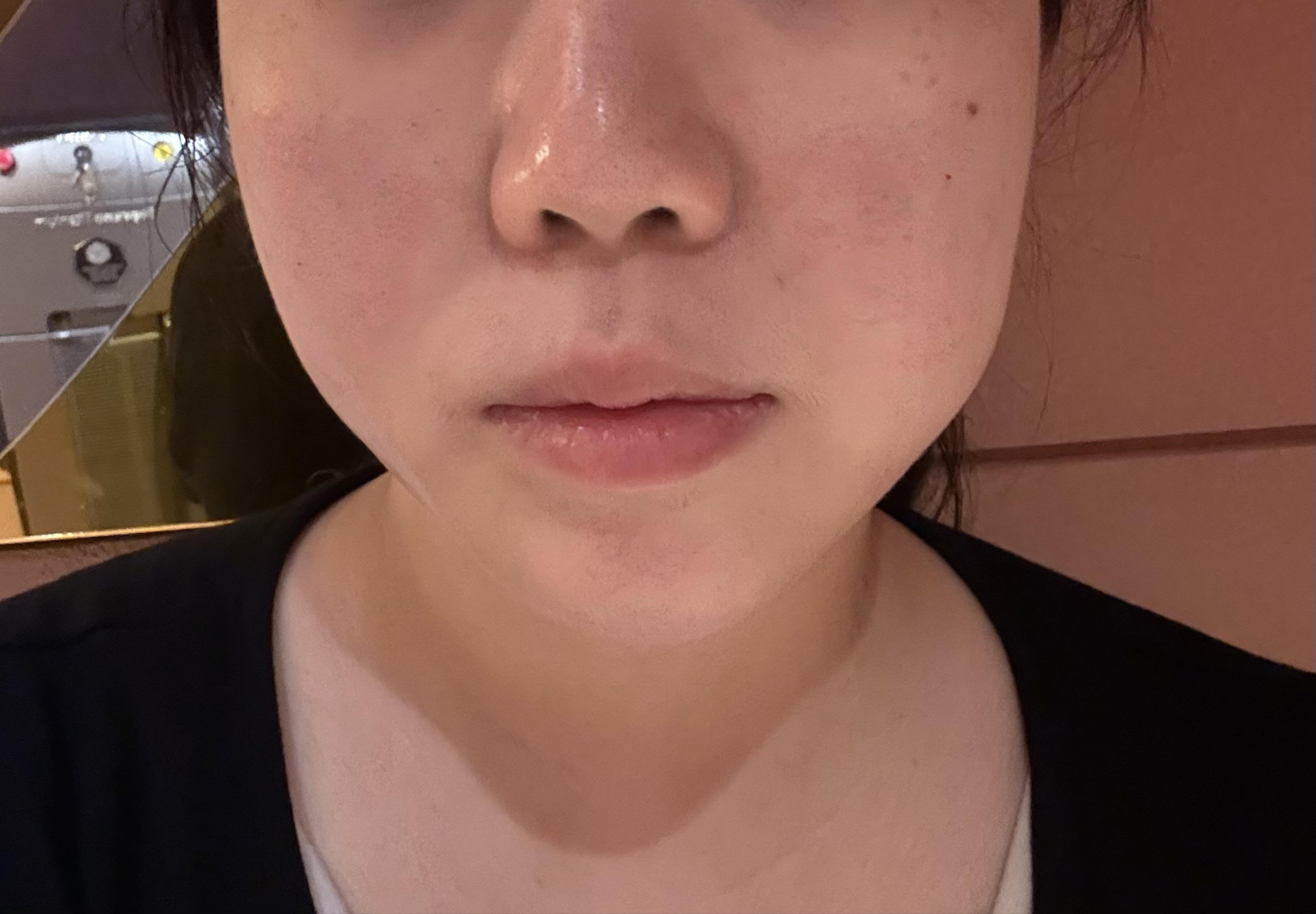 後