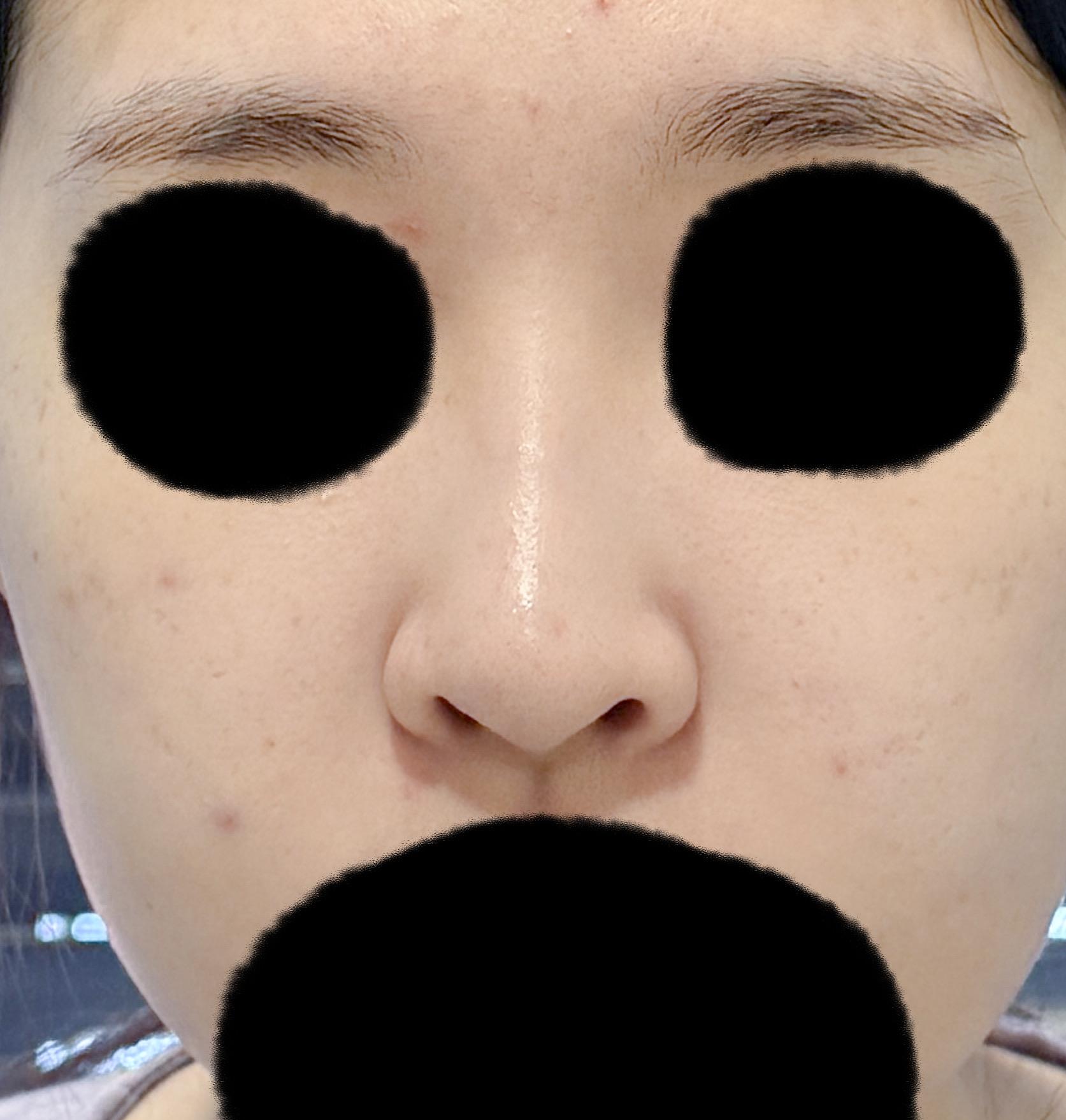 後