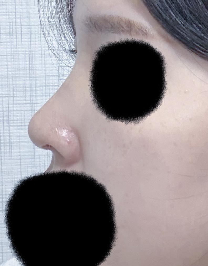 後