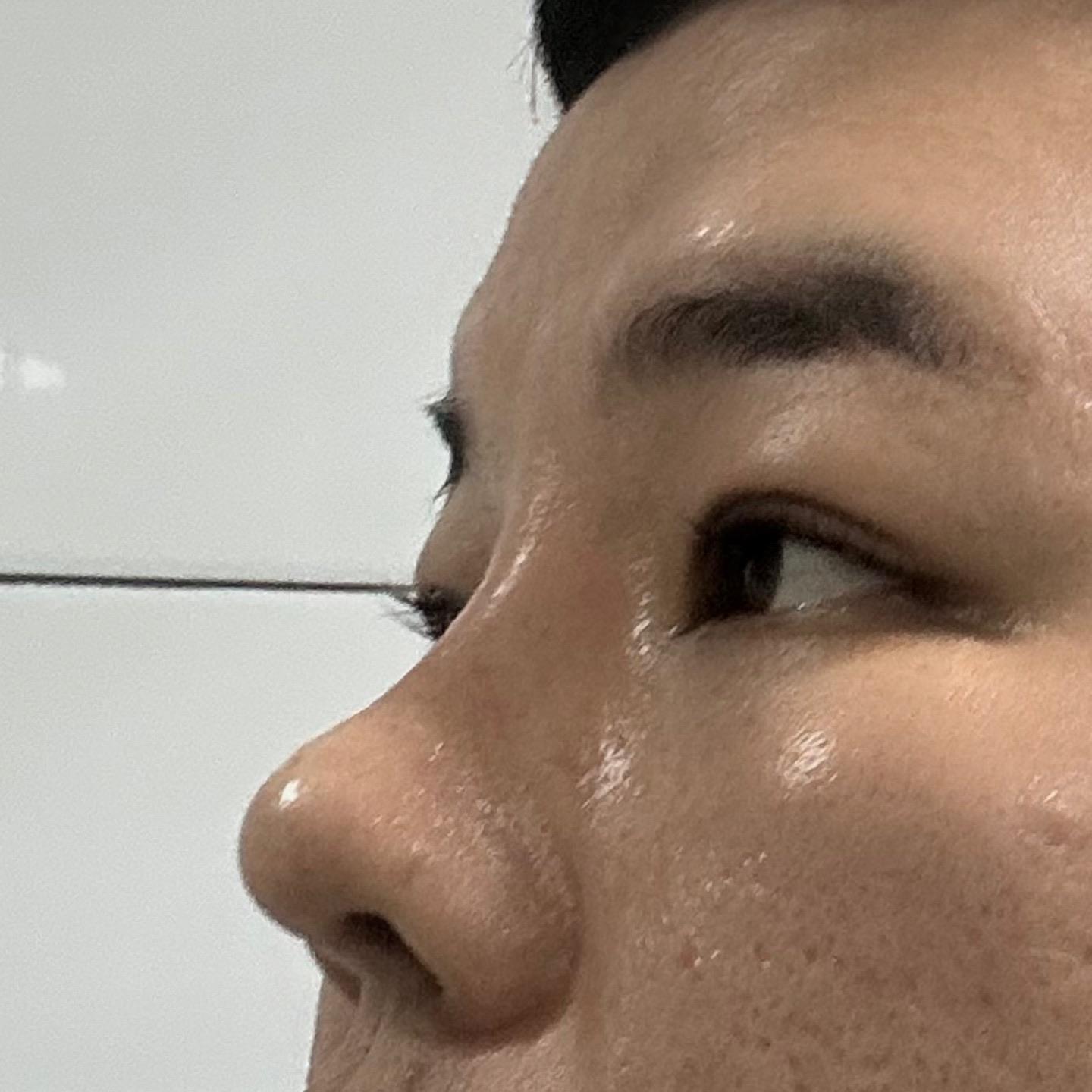 後