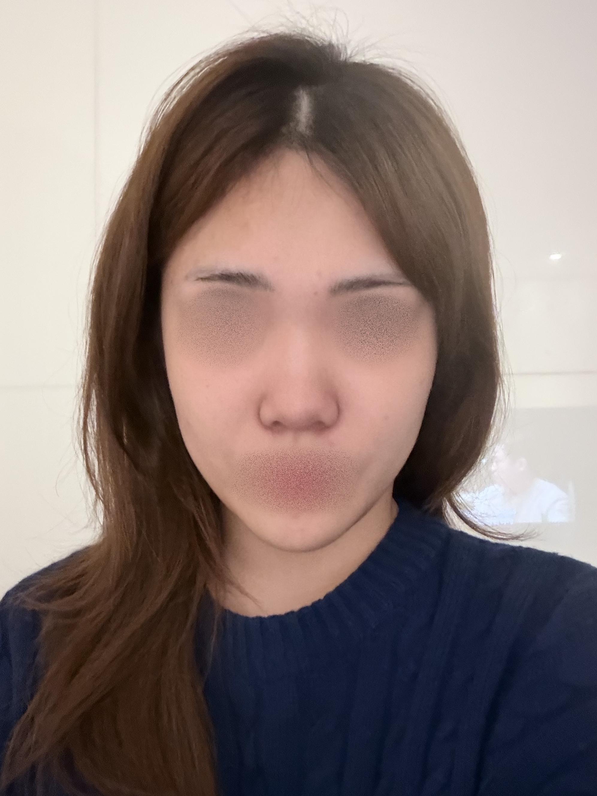 後