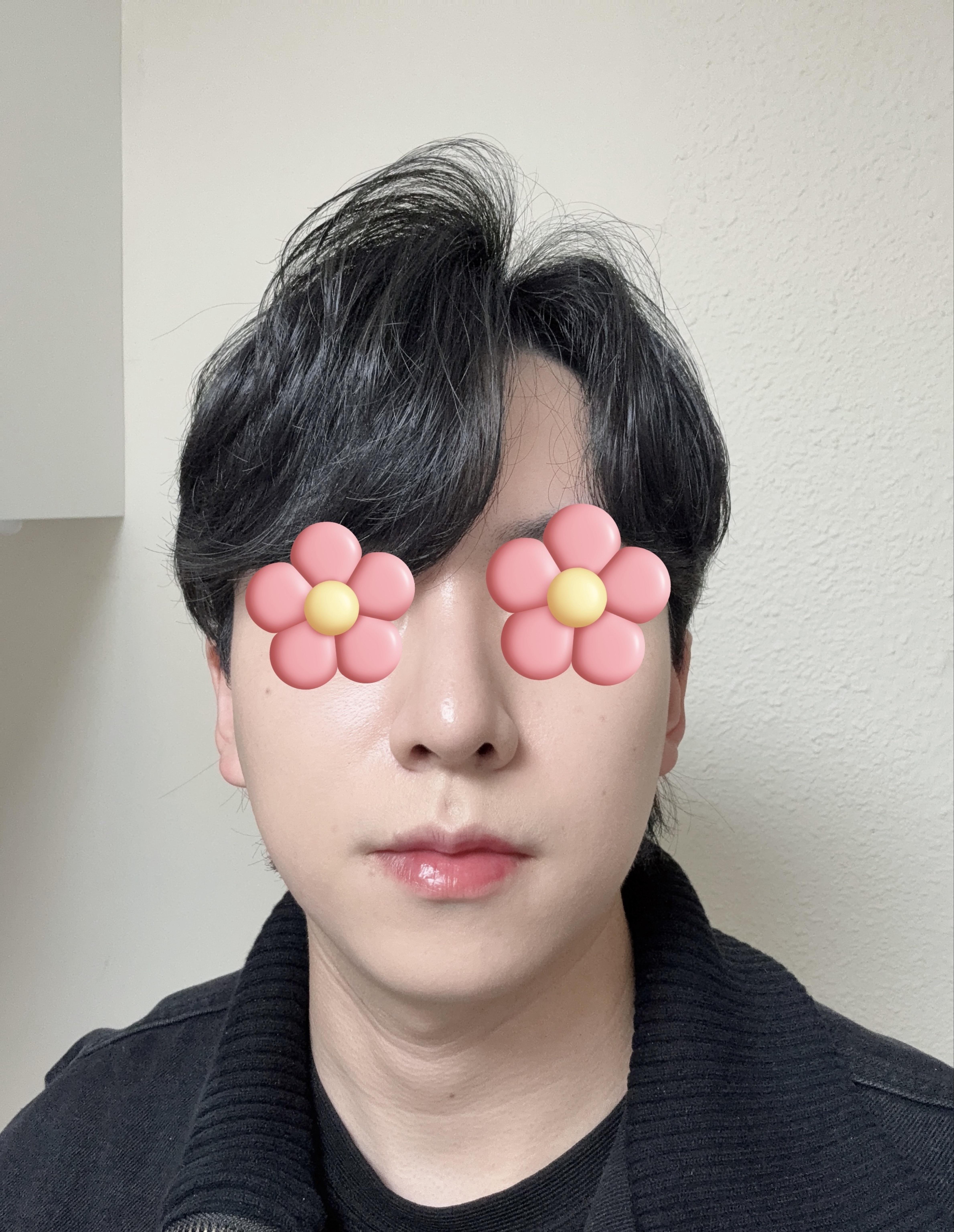 後