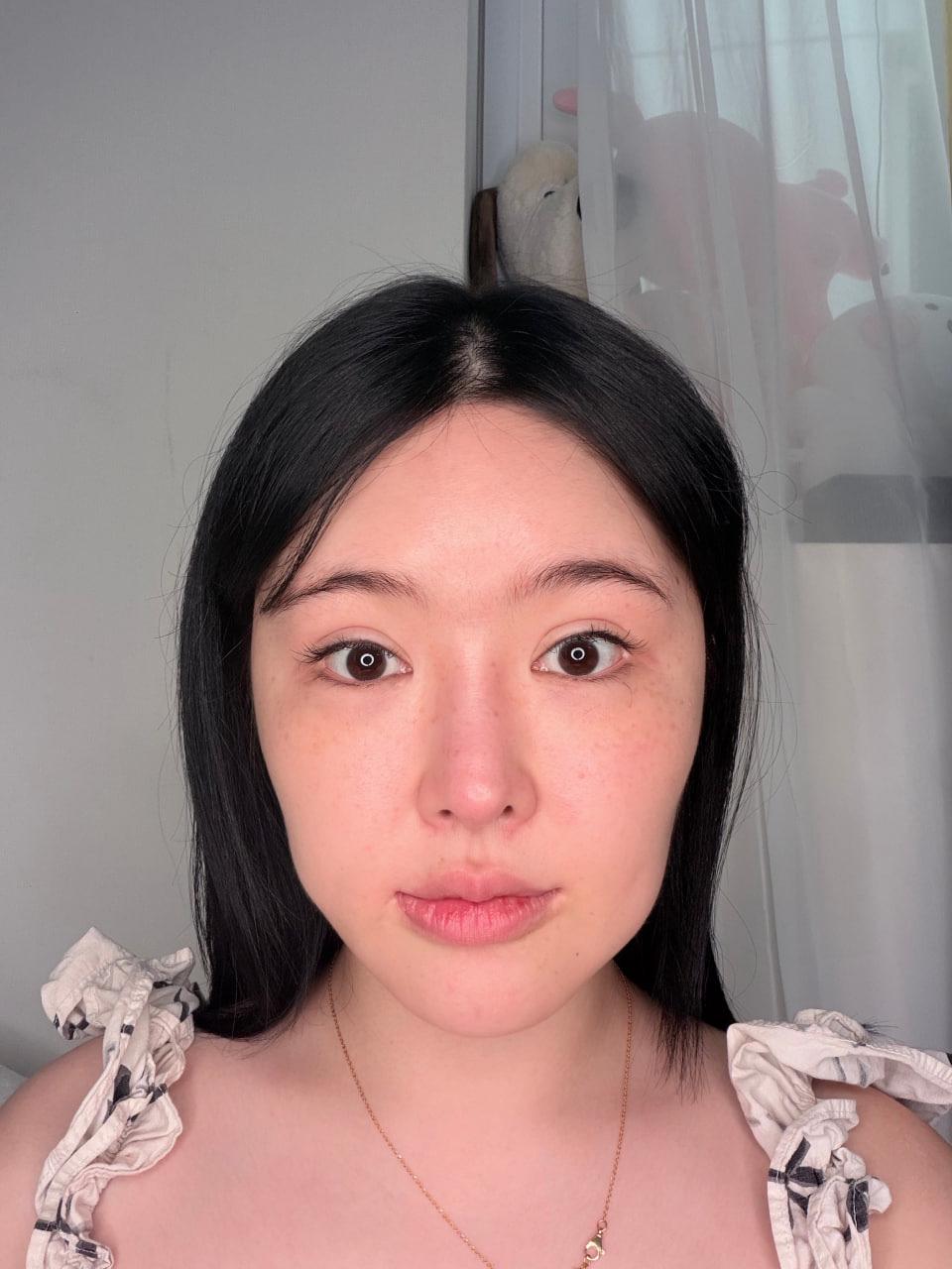 後