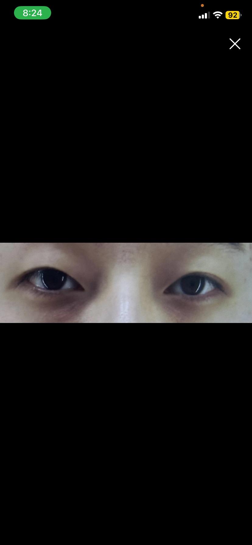 後