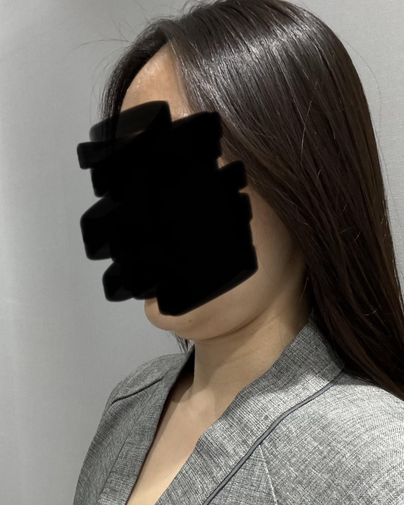 後
