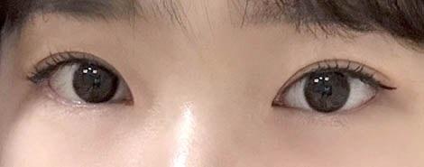 後