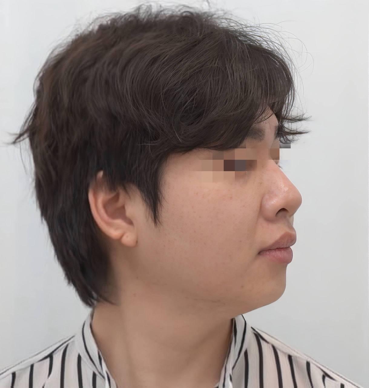 後