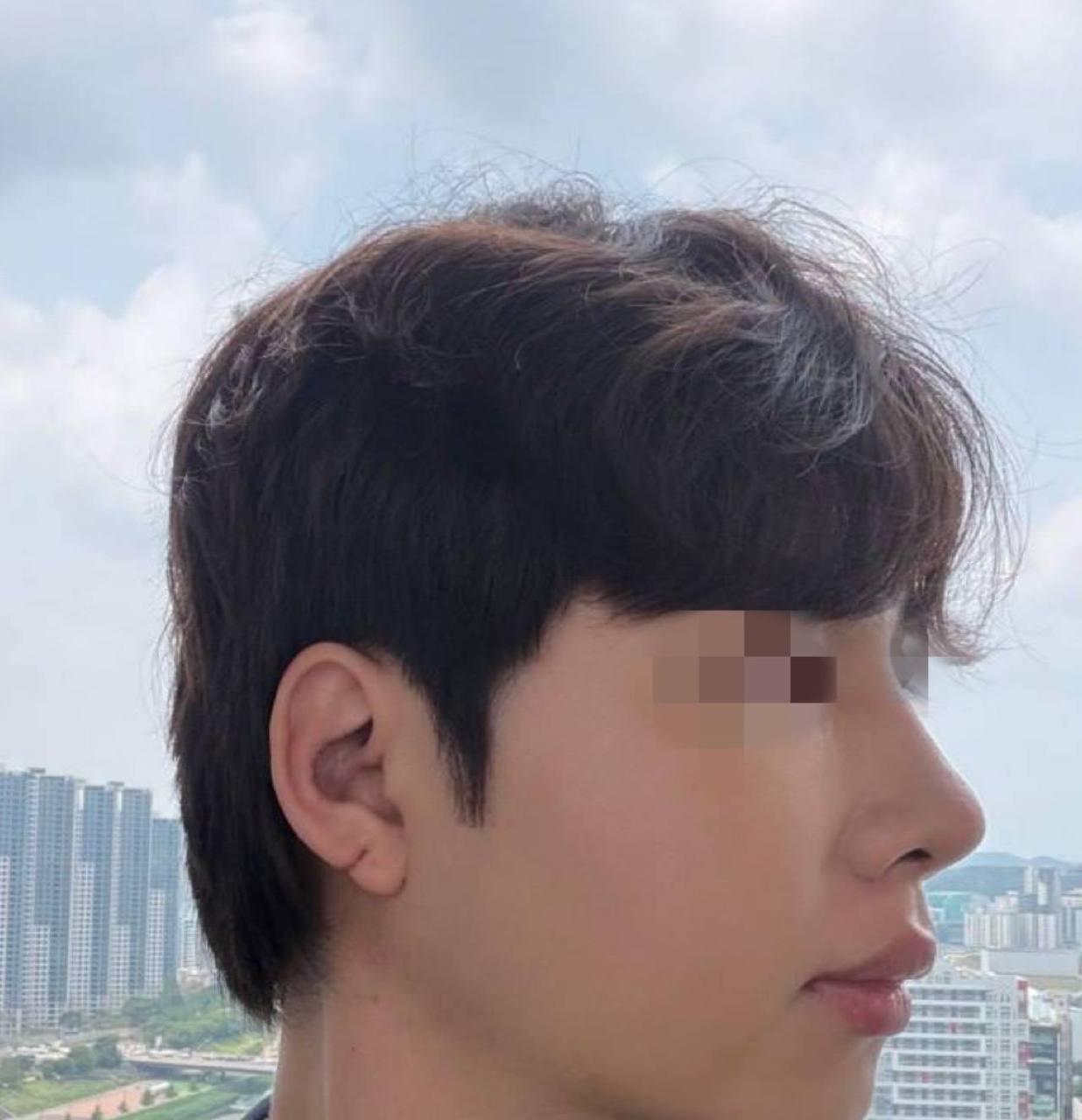 後