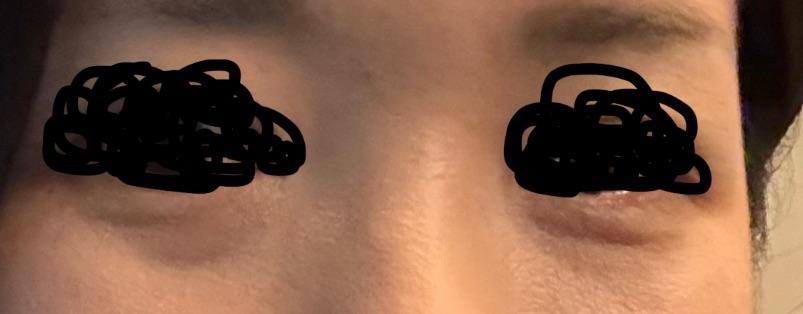 後